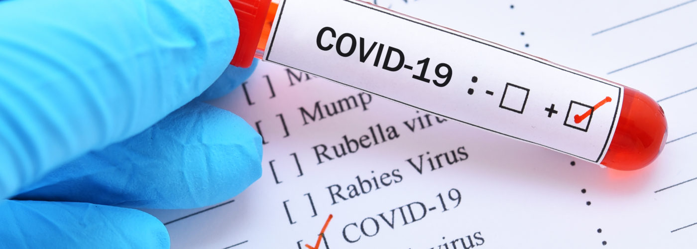 Positive COVID-19 test